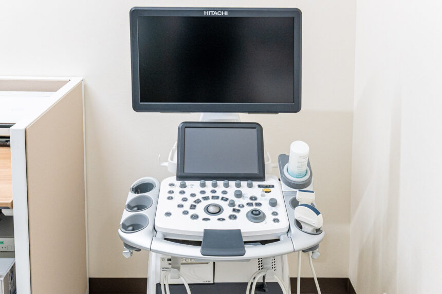 超音波診断装置